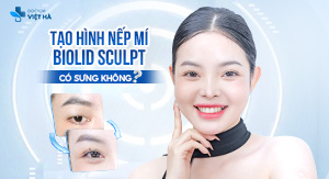 TẠO HÌNH NẾP MÍ BẰNG BIOLID SCUPLT CÓ SƯNG KHÔNG?