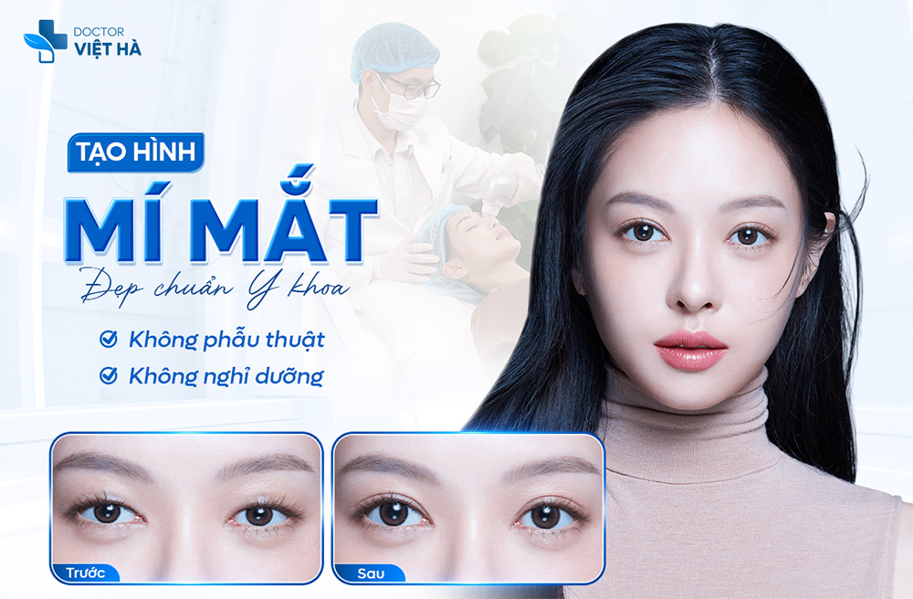 VÌ SAO NÊN TẠO HÌNH NẾP MÍ KHÔNG XÂM LẤN BẰNG CÔNG NGHỆ BIOLID SCUPLT?